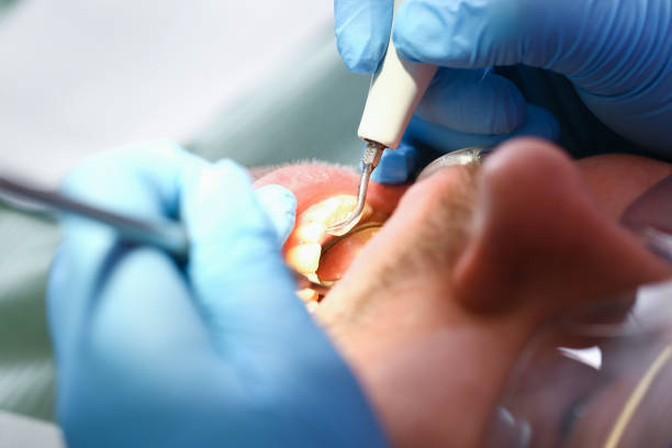 Best Emergency Dentist for Knocked-Out Tooth in Rutledge, TN